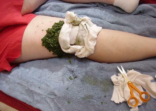 A warm compress of crushed cabbage leaves on a painful arthritic knee joint